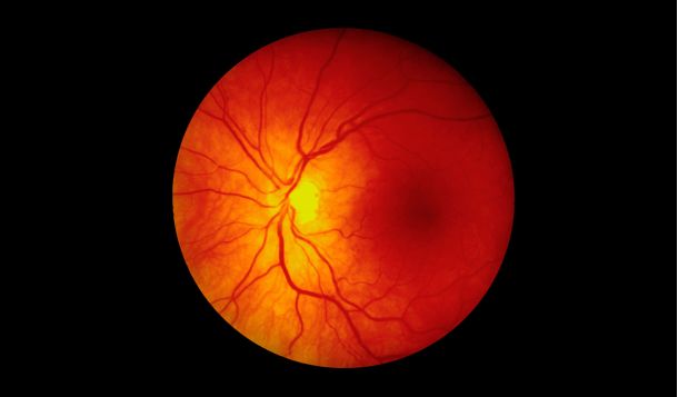 Οφθαλμολογικές Υπηρεσίες Athens Orasis - Παθήσεις Αμφιβληστροειδούς